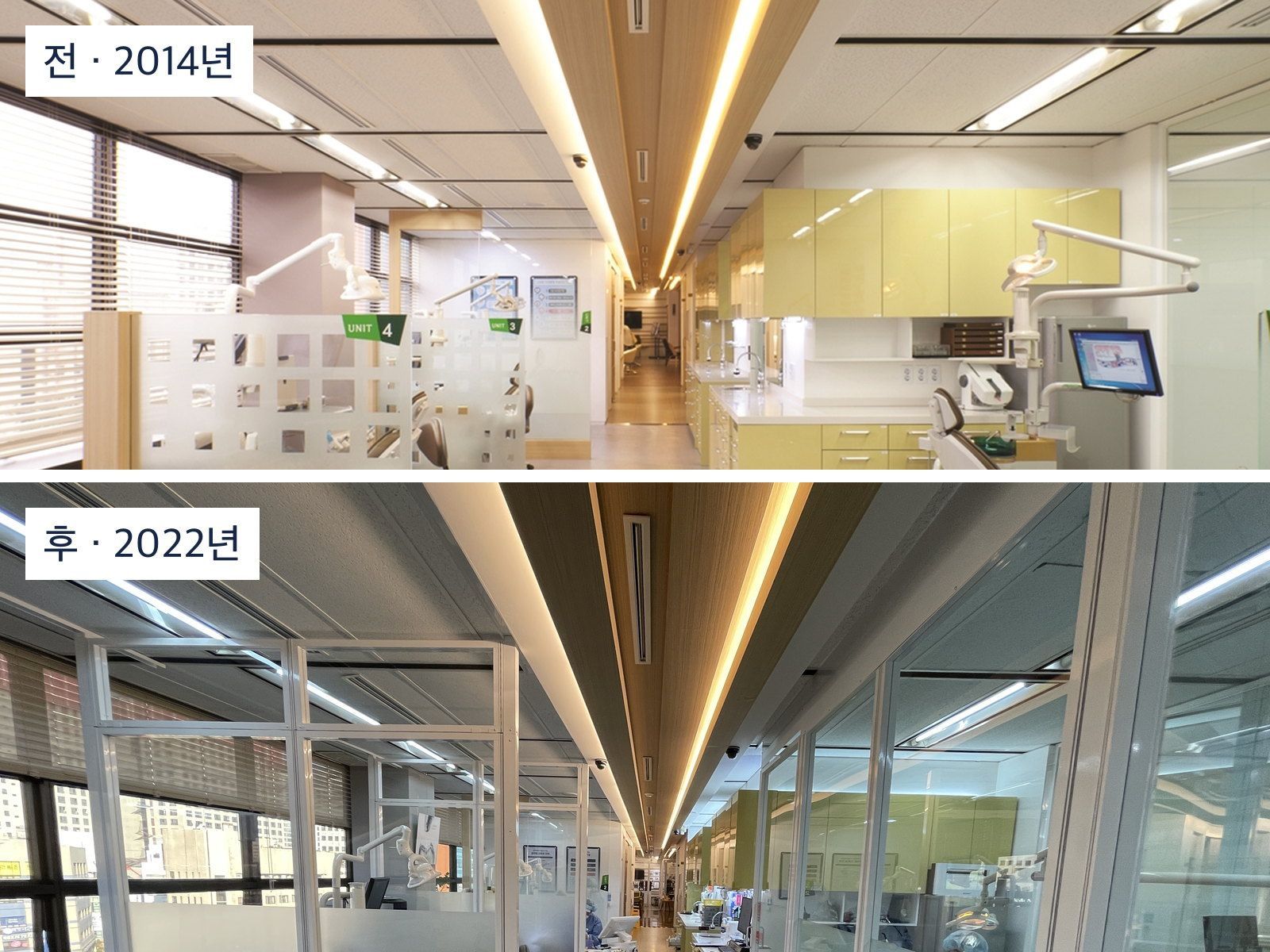 위아래로 쌓은 비교 사진. 위는 2014년 치과 진료실 통로로, 오른쪽의 연두색 캐비닛과 유닛이 통로 쪽으로 열려 있고 칸막이 위로 천장이 막힘 없이 이어진다. 아래는 같은 통로의 2022년 모습으로, 오른쪽이 천장까지 닿는 유리 벽 안에 들어가 있다. 왼쪽의 낮은 칸막이는 두 장 모두 천장에 닿지 않는다